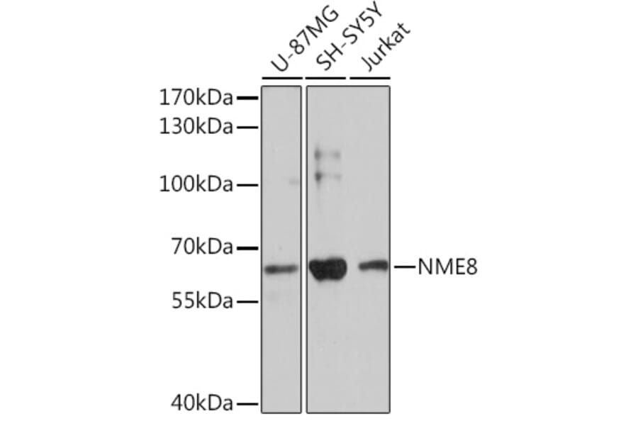 Western Blot - Anti-NME8 Antibody (A93271) - Antibodies.com