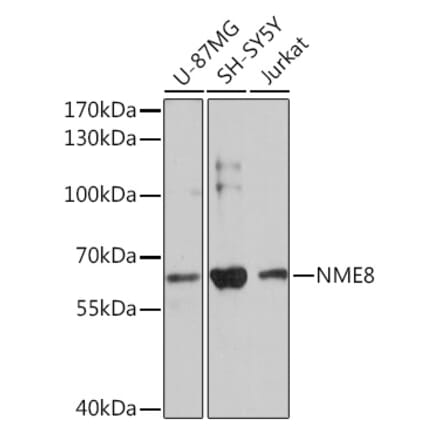Western Blot - Anti-NME8 Antibody (A93271) - Antibodies.com