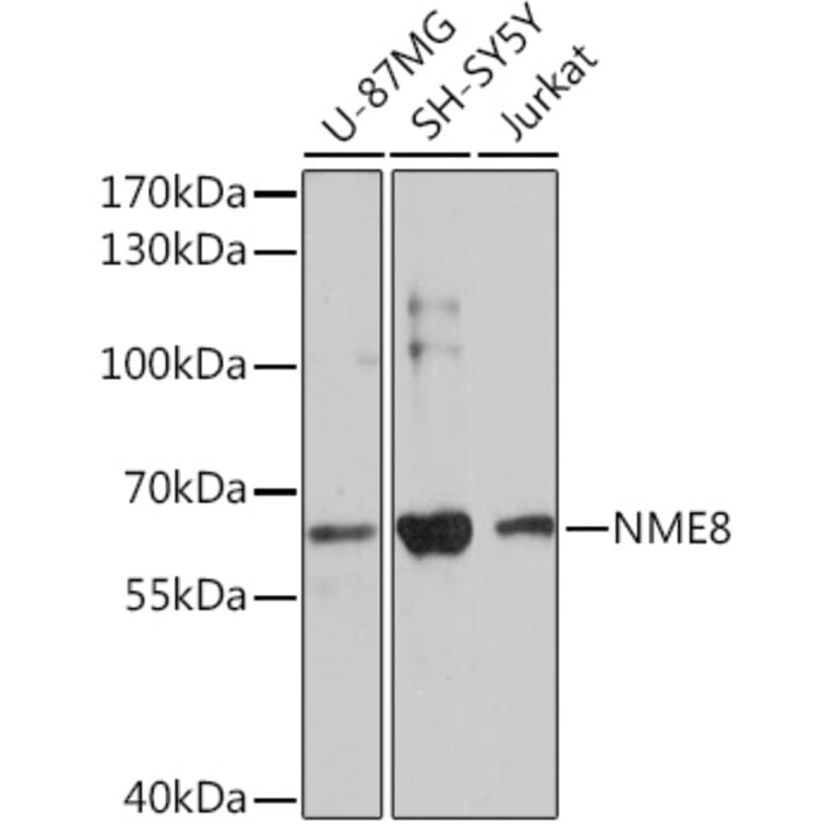 Western Blot - Anti-NME8 Antibody (A93271) - Antibodies.com