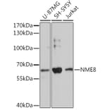 Western Blot - Anti-NME8 Antibody (A93271) - Antibodies.com
