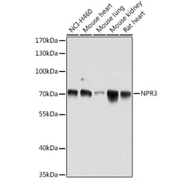 Western Blot - Anti-NPR-C Antibody (A93275) - Antibodies.com