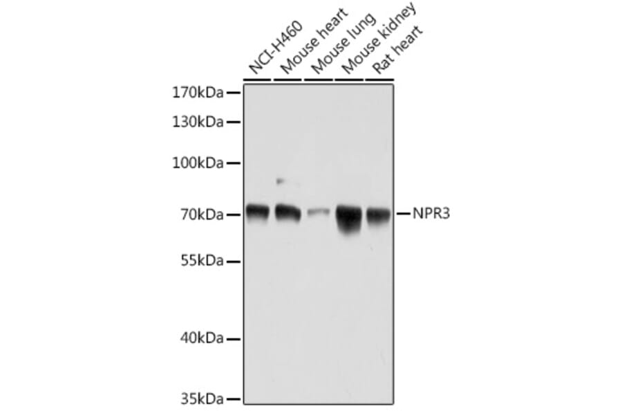 Western Blot - Anti-NPR-C Antibody (A93275) - Antibodies.com