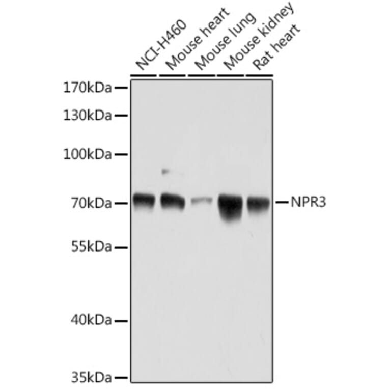 Western Blot - Anti-NPR-C Antibody (A93275) - Antibodies.com