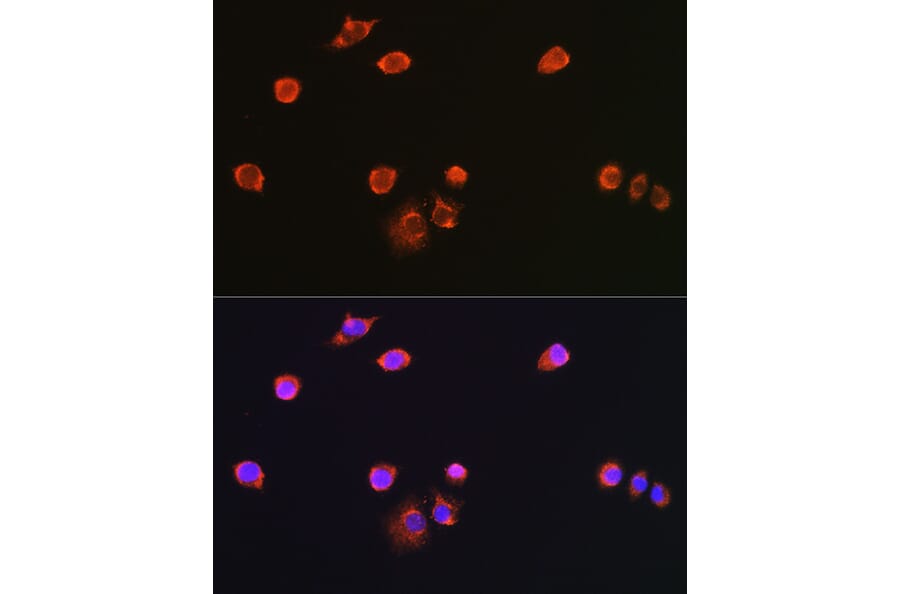 Immunofluorescence - Anti-NPR-C Antibody (A93275) - Antibodies.com