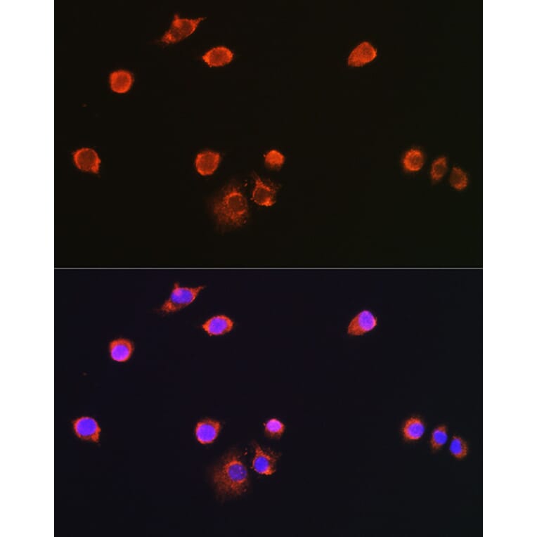 Immunofluorescence - Anti-NPR-C Antibody (A93275) - Antibodies.com