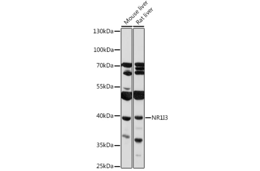 Western Blot - Anti-Constitutive androstane receptor Antibody (A93279) - Antibodies.com