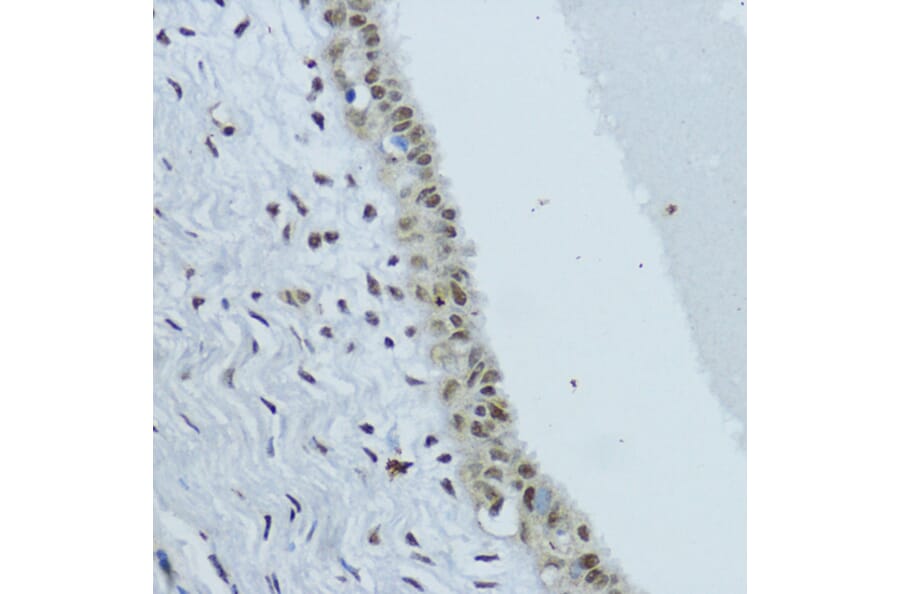 Immunohistochemistry - Anti-Constitutive androstane receptor Antibody (A93279) - Antibodies.com