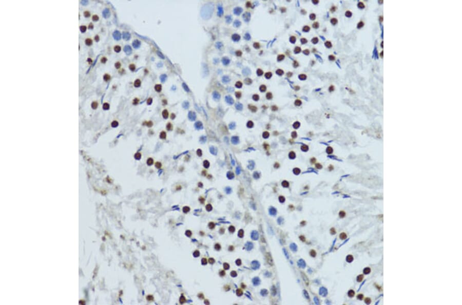 Immunohistochemistry - Anti-Constitutive androstane receptor Antibody (A93279) - Antibodies.com