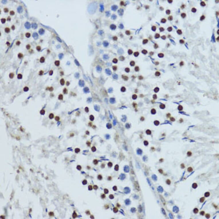 Immunohistochemistry - Anti-Constitutive androstane receptor Antibody (A93279) - Antibodies.com