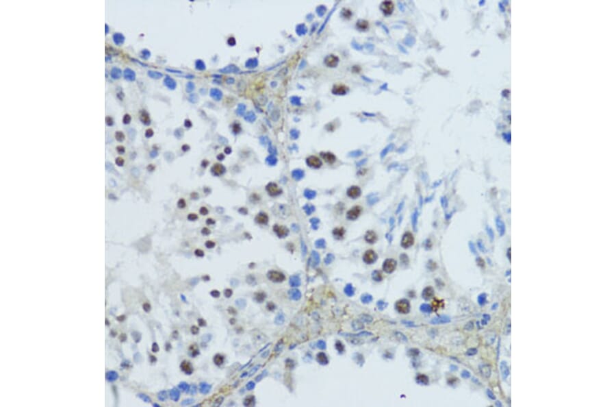 Immunohistochemistry - Anti-Constitutive androstane receptor Antibody (A93279) - Antibodies.com