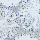 Immunohistochemistry - Anti-Constitutive androstane receptor Antibody (A93279) - Antibodies.com