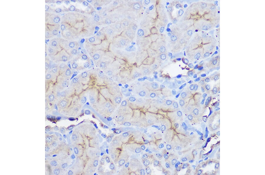 Immunohistochemistry - Anti-CD73 Antibody (A93280) - Antibodies.com