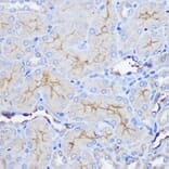 Immunohistochemistry - Anti-CD73 Antibody (A93280) - Antibodies.com