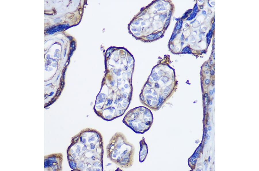 Immunohistochemistry - Anti-CD73 Antibody (A93280) - Antibodies.com