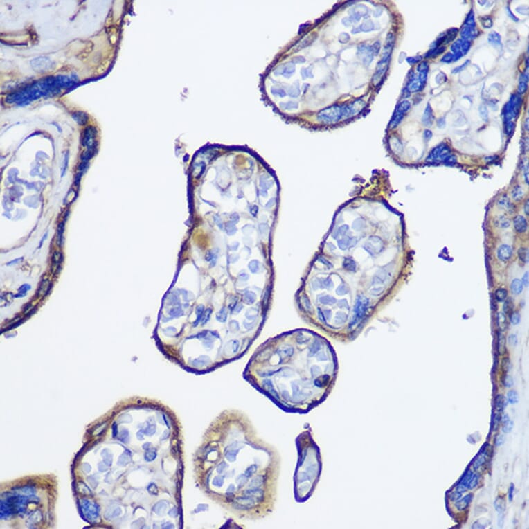 Immunohistochemistry - Anti-CD73 Antibody (A93280) - Antibodies.com