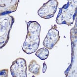 Immunohistochemistry - Anti-CD73 Antibody (A93280) - Antibodies.com