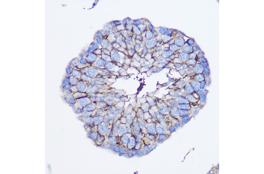 Immunohistochemistry - Anti-CD73 Antibody (A93280) - Antibodies.com