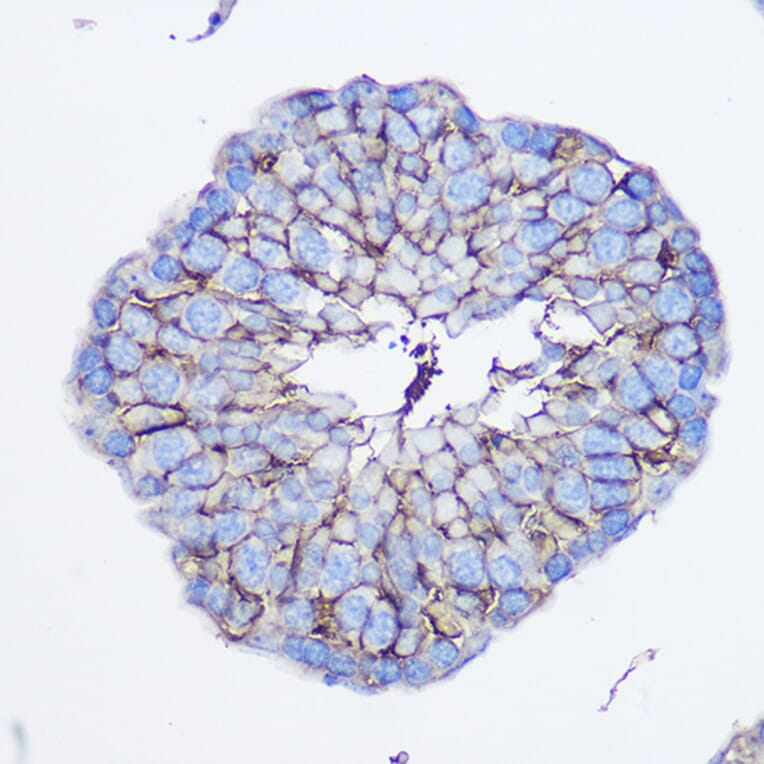 Immunohistochemistry - Anti-CD73 Antibody (A93280) - Antibodies.com