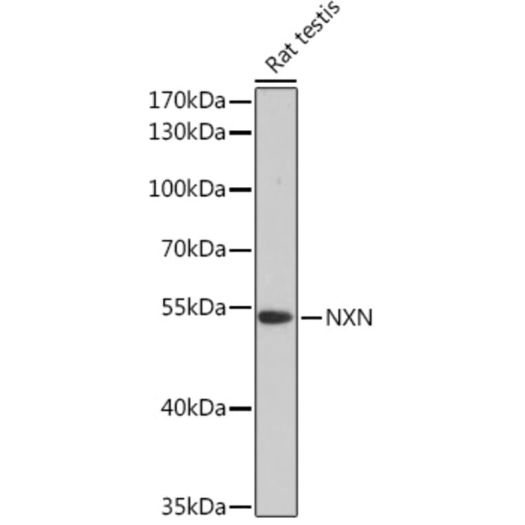 Western Blot - Anti-NXN/NRX Antibody (A93282) - Antibodies.com