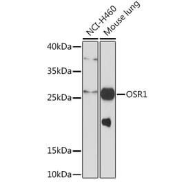 Western Blot - Anti-OSR1 Antibody (A93285) - Antibodies.com