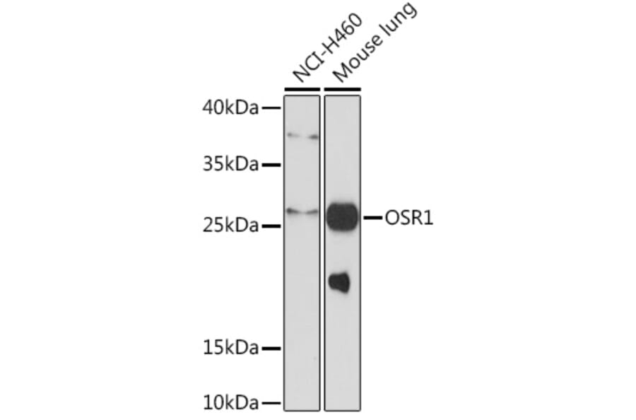 Western Blot - Anti-OSR1 Antibody (A93285) - Antibodies.com