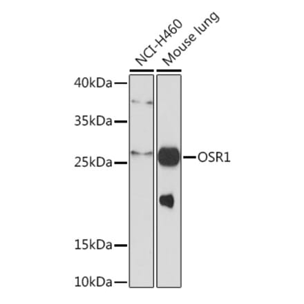 Western Blot - Anti-OSR1 Antibody (A93285) - Antibodies.com