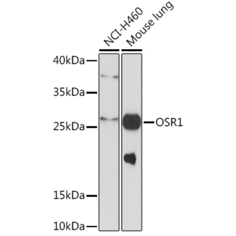 Western Blot - Anti-OSR1 Antibody (A93285) - Antibodies.com