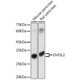 Western Blot - Anti-OVOL2 Antibody (A93286) - Antibodies.com