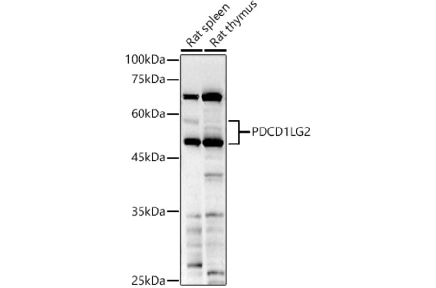 Western Blot - Anti-PD-L2 Antibody (A93287) - Antibodies.com