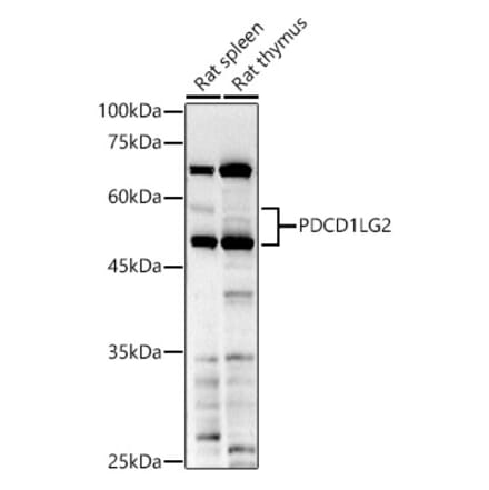 Western Blot - Anti-PD-L2 Antibody (A93287) - Antibodies.com