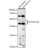 Western Blot - Anti-PD-L2 Antibody (A93287) - Antibodies.com