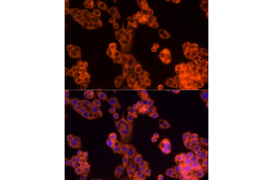Immunofluorescence - Anti-PD-L2 Antibody (A93287) - Antibodies.com
