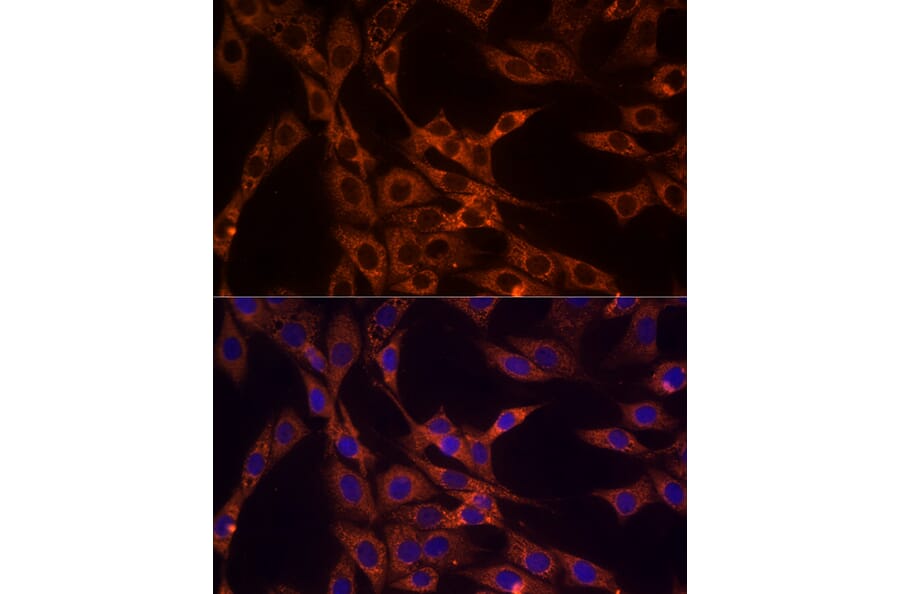 Immunofluorescence - Anti-PD-L2 Antibody (A93287) - Antibodies.com