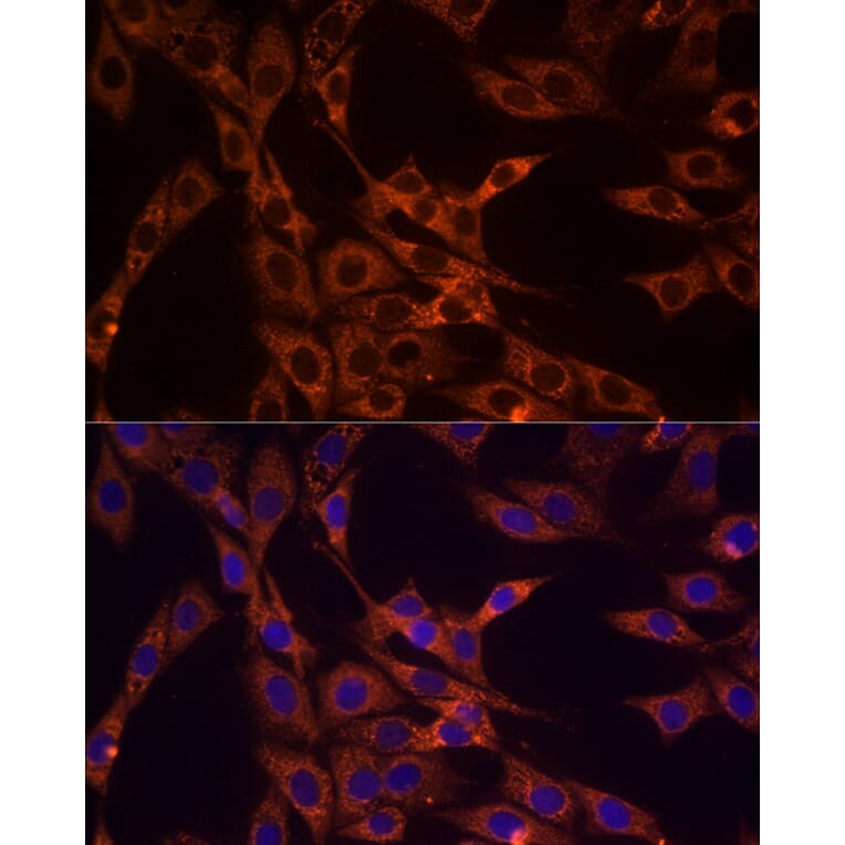 Immunofluorescence - Anti-PD-L2 Antibody (A93287) - Antibodies.com