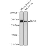 Western Blot - Anti-PDE12 Antibody (A93288) - Antibodies.com