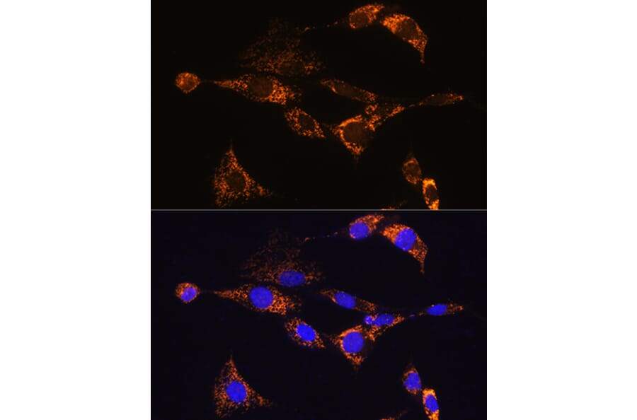 Immunofluorescence - Anti-PDE12 Antibody (A93288) - Antibodies.com