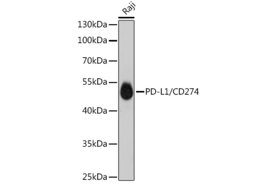 Western Blot - Anti-PD-L1 Antibody [ARC5110-01] (A93289) - Antibodies.com