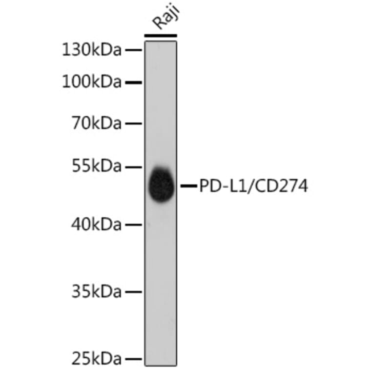 Western Blot - Anti-PD-L1 Antibody [ARC5110-01] (A93289) - Antibodies.com