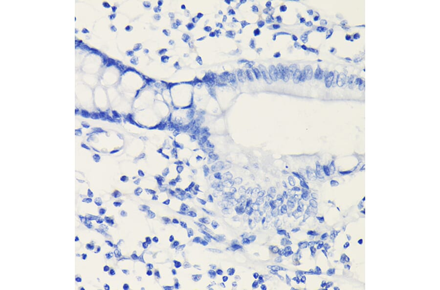 Immunohistochemistry - Anti-PD-L1 Antibody [ARC5110-01] (A93289) - Antibodies.com