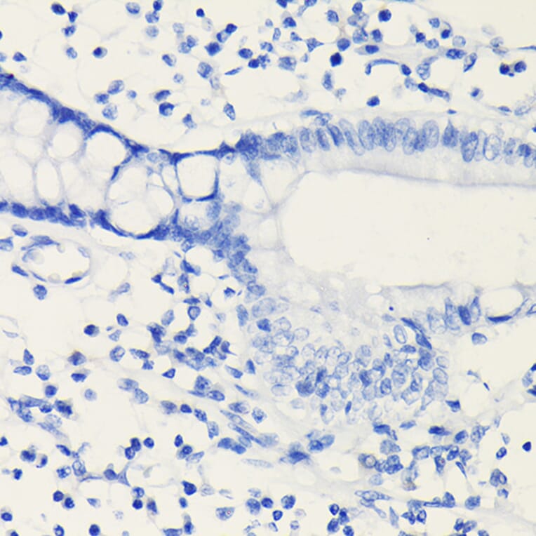 Immunohistochemistry - Anti-PD-L1 Antibody [ARC5110-01] (A93289) - Antibodies.com