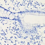 Immunohistochemistry - Anti-PD-L1 Antibody [ARC5110-01] (A93289) - Antibodies.com