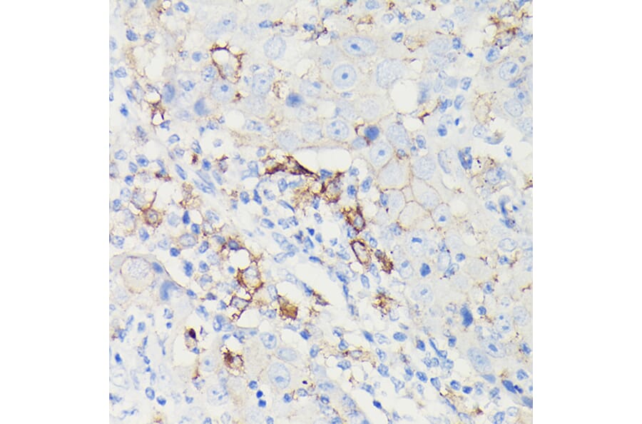 Immunohistochemistry - Anti-PD-L1 Antibody [ARC5110-01] (A93289) - Antibodies.com