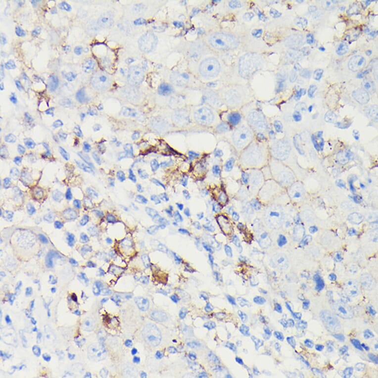 Immunohistochemistry - Anti-PD-L1 Antibody [ARC5110-01] (A93289) - Antibodies.com