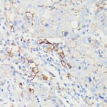 Immunohistochemistry - Anti-PD-L1 Antibody [ARC5110-01] (A93289) - Antibodies.com