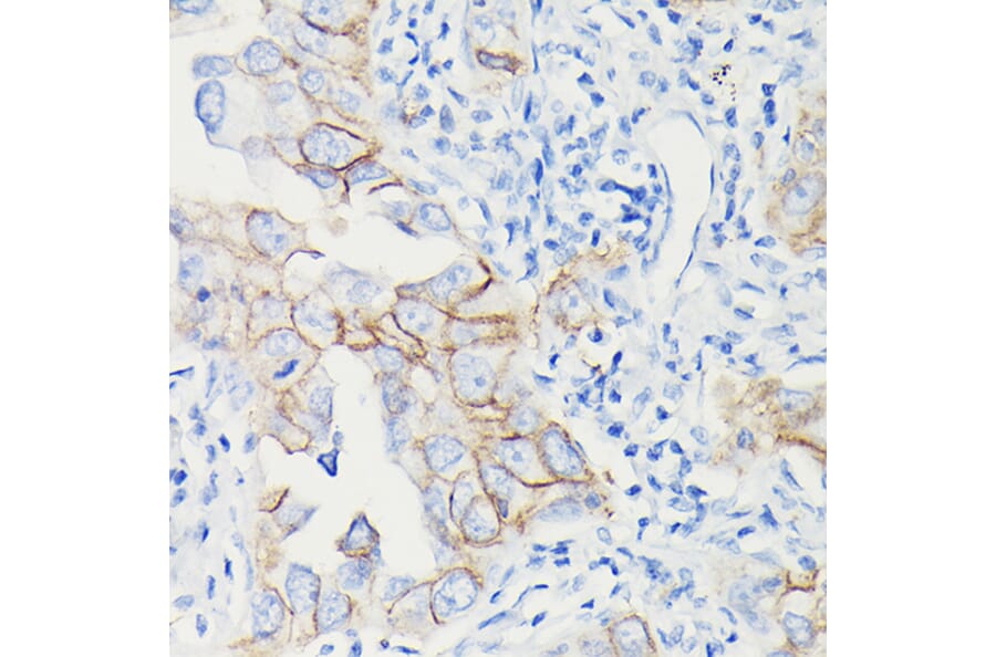 Immunohistochemistry - Anti-PD-L1 Antibody [ARC5110-01] (A93289) - Antibodies.com