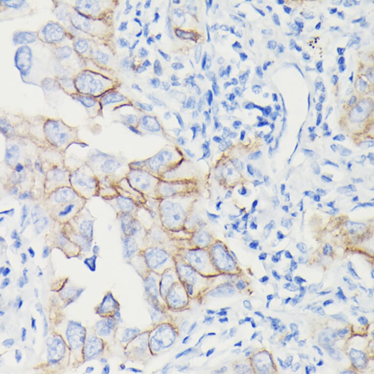 Immunohistochemistry - Anti-PD-L1 Antibody [ARC5110-01] (A93289) - Antibodies.com