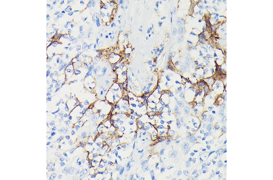 Immunohistochemistry - Anti-PD-L1 Antibody [ARC5110-01] (A93289) - Antibodies.com