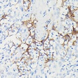 Immunohistochemistry - Anti-PD-L1 Antibody [ARC5110-01] (A93289) - Antibodies.com