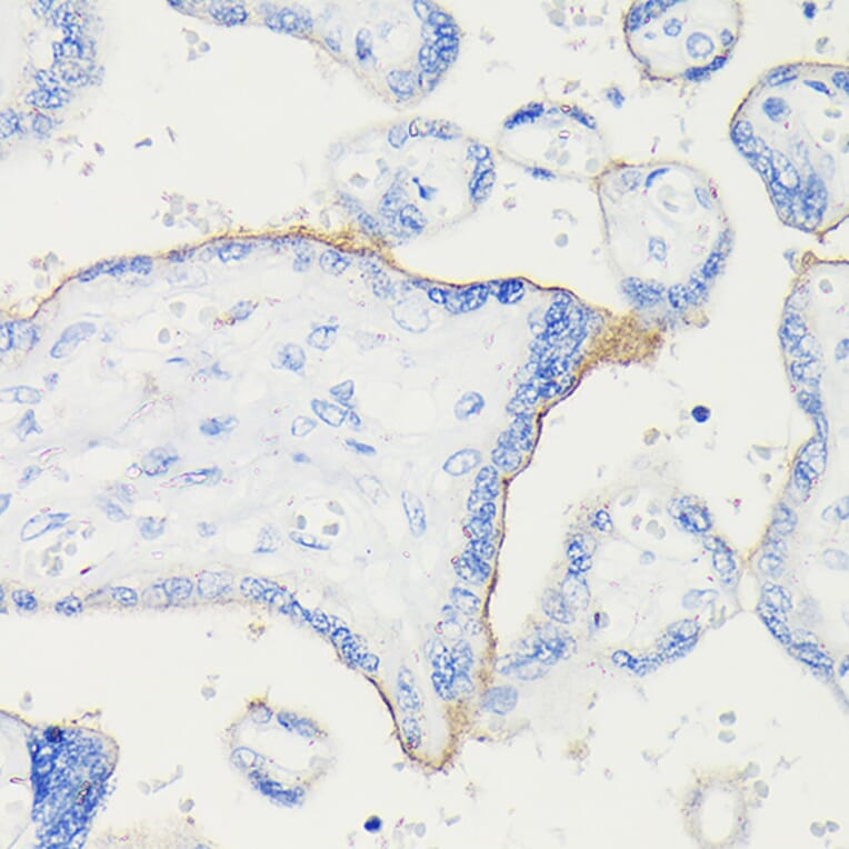 Immunohistochemistry - Anti-PD-L1 Antibody [ARC5110-01] (A93289) - Antibodies.com