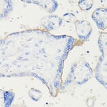 Immunohistochemistry - Anti-PD-L1 Antibody [ARC5110-01] (A93289) - Antibodies.com